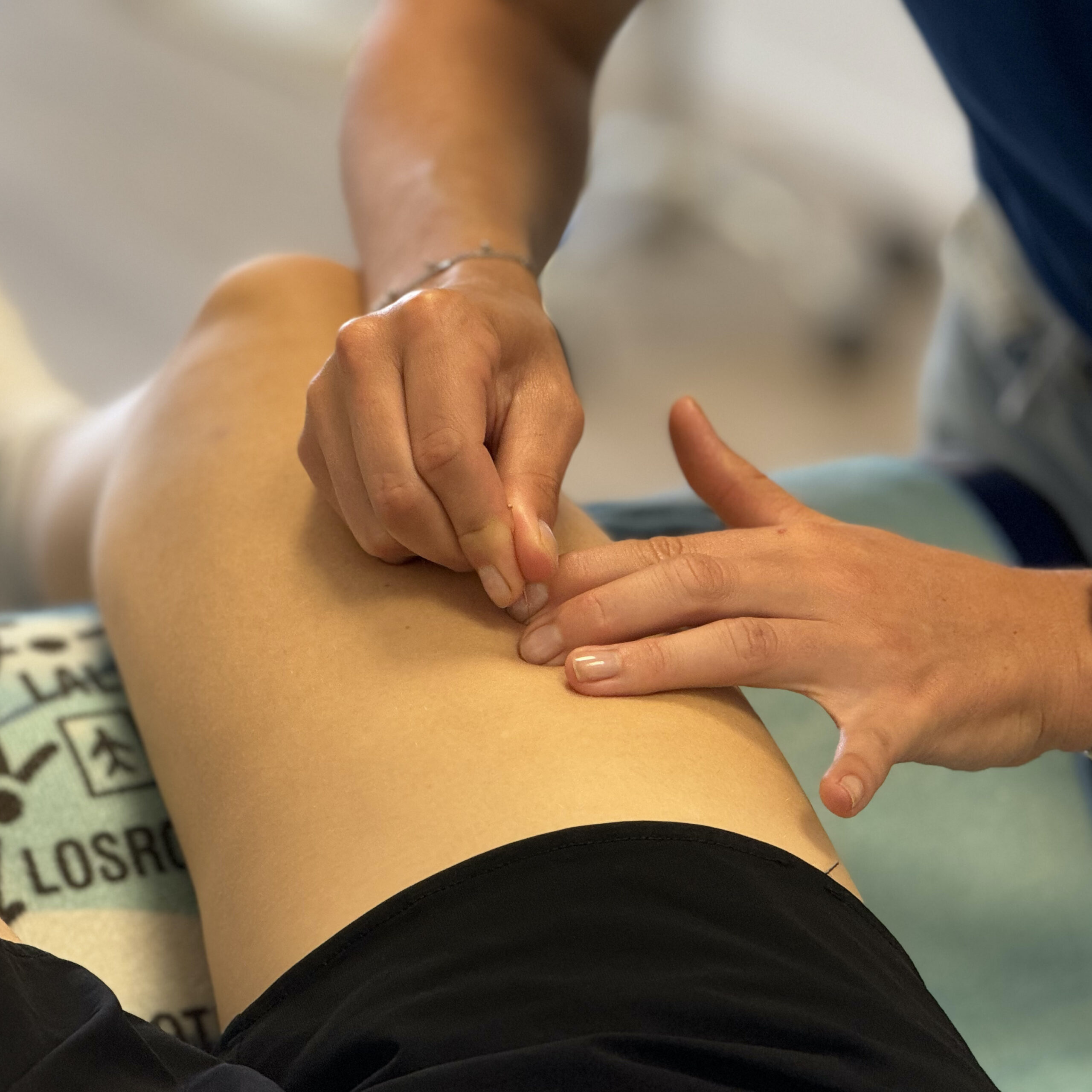 Dry needling - TopFysio - Fysiotherapeut Leeuwarden