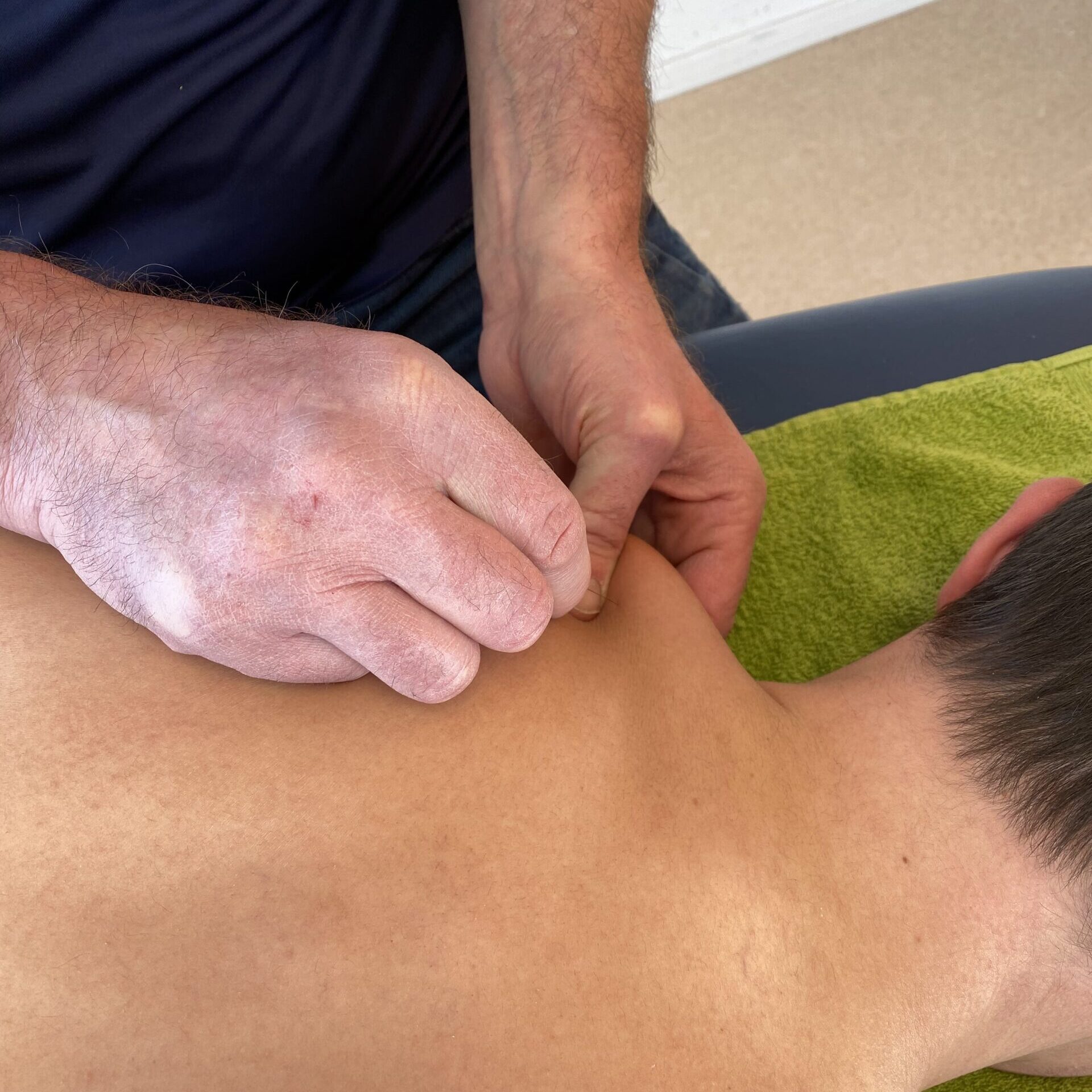 Dry needling behandeling bij TopFysio Leeuwarden