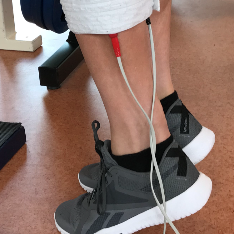 RSQ1 behandeling bij achillespeesontsteking sportfysiotherapie Leeuwarden