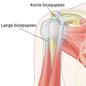 Verloop van de lange bicepspees vanuit de schouder naar de bovenarm
