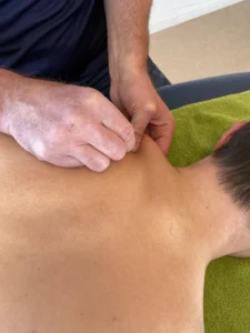 Dry needling van een triggerpoint in de nekspieren.
